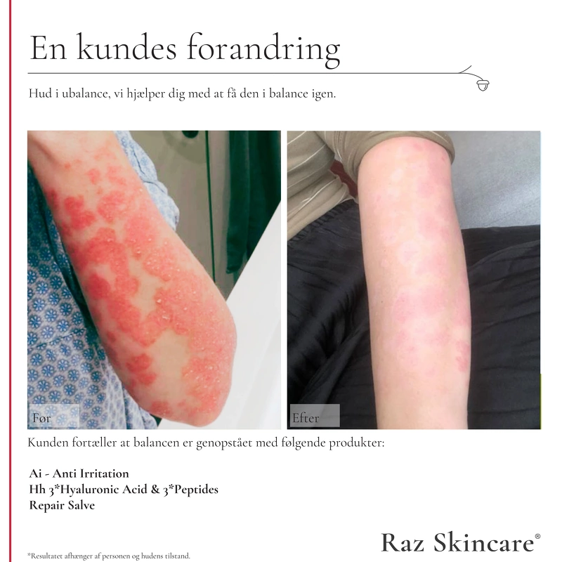 Raz Skincare Repair 100 ml