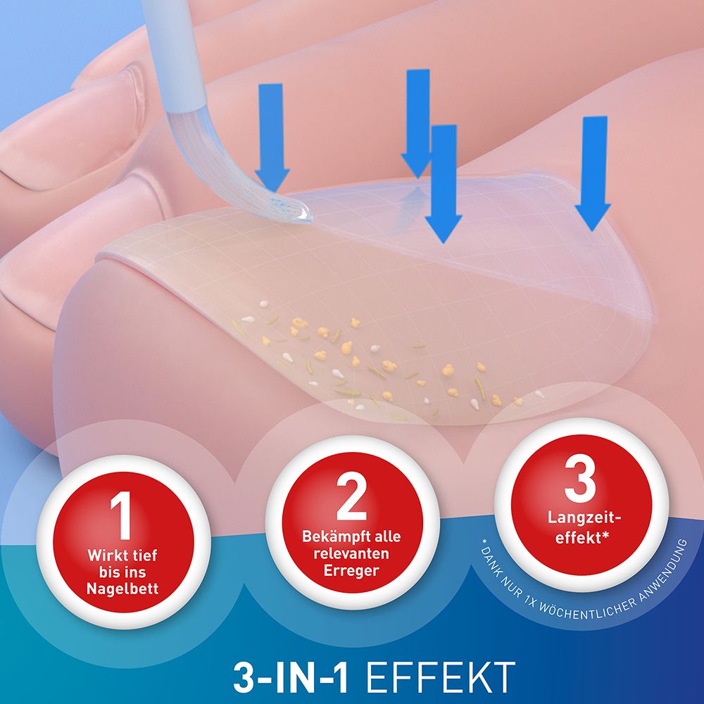 LOCERYL® Nagellack gegen Nagelpilz mit DIREKT-Applikator + LOCERYL® Creme
