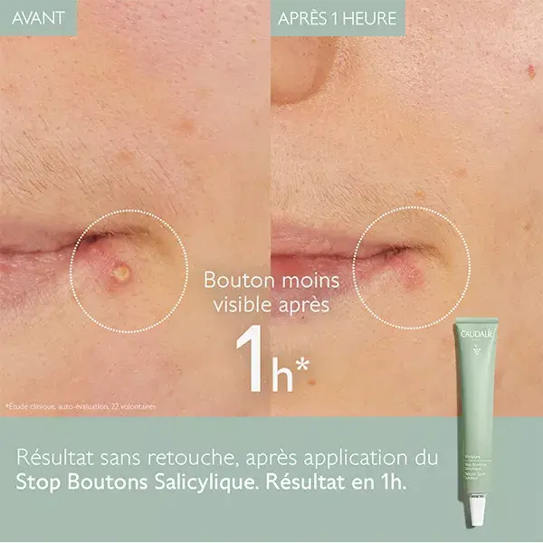 Caudalie Vinopure Stop Spot Treatment Salicylic 15ml