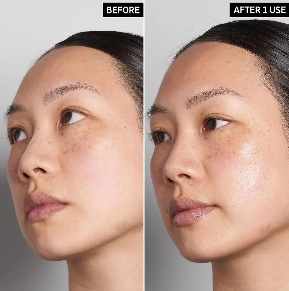 Hyaluronic Acid Serum