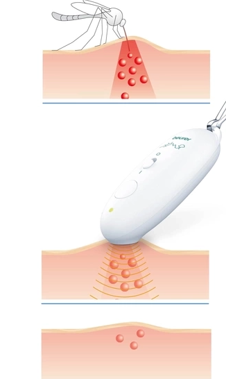 Insektenstichheiler BR 10 Elektrischer Anti-Itch Juckreiz Stift Mücken / Insekten Stich Pen inkl. 2x AAA Batterien (60318) - Weiss