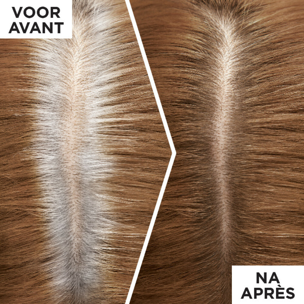 L'Oréal Magic Retouch Uitgroeispray Donkerblond75 ml