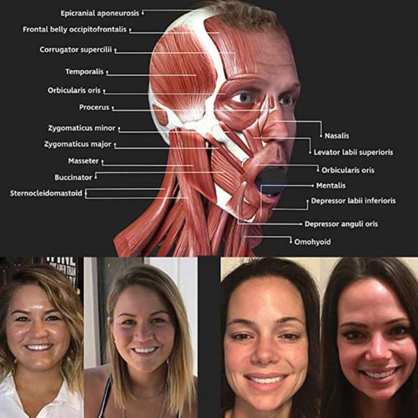 INF Kjevetrener i sort silikon for ansiktsmuskler  1 Pack