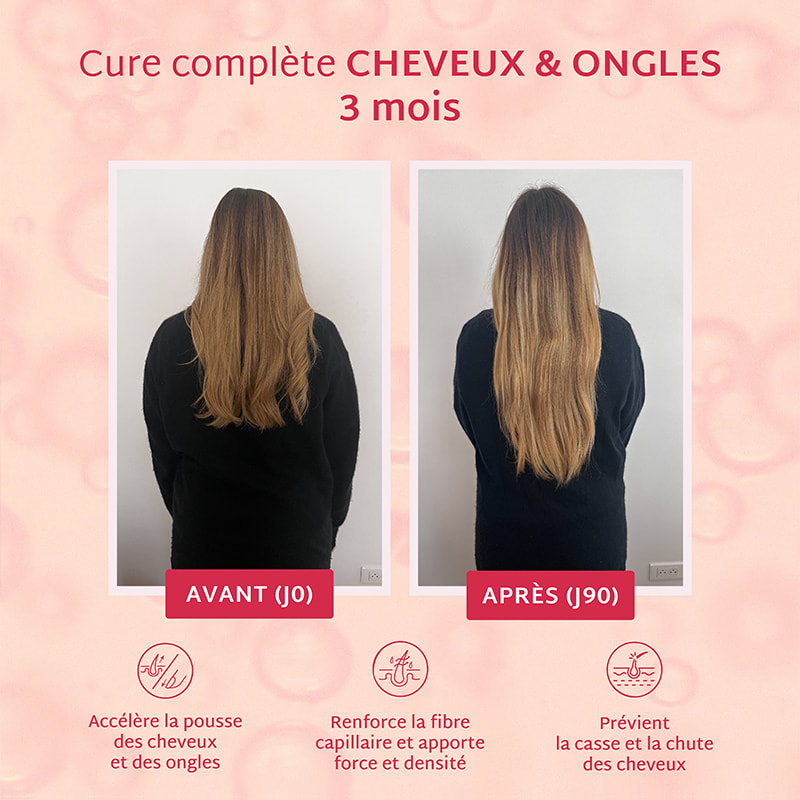 Cure gummies cheveux & ongles - Framboise - Sans sucres - 3 mois