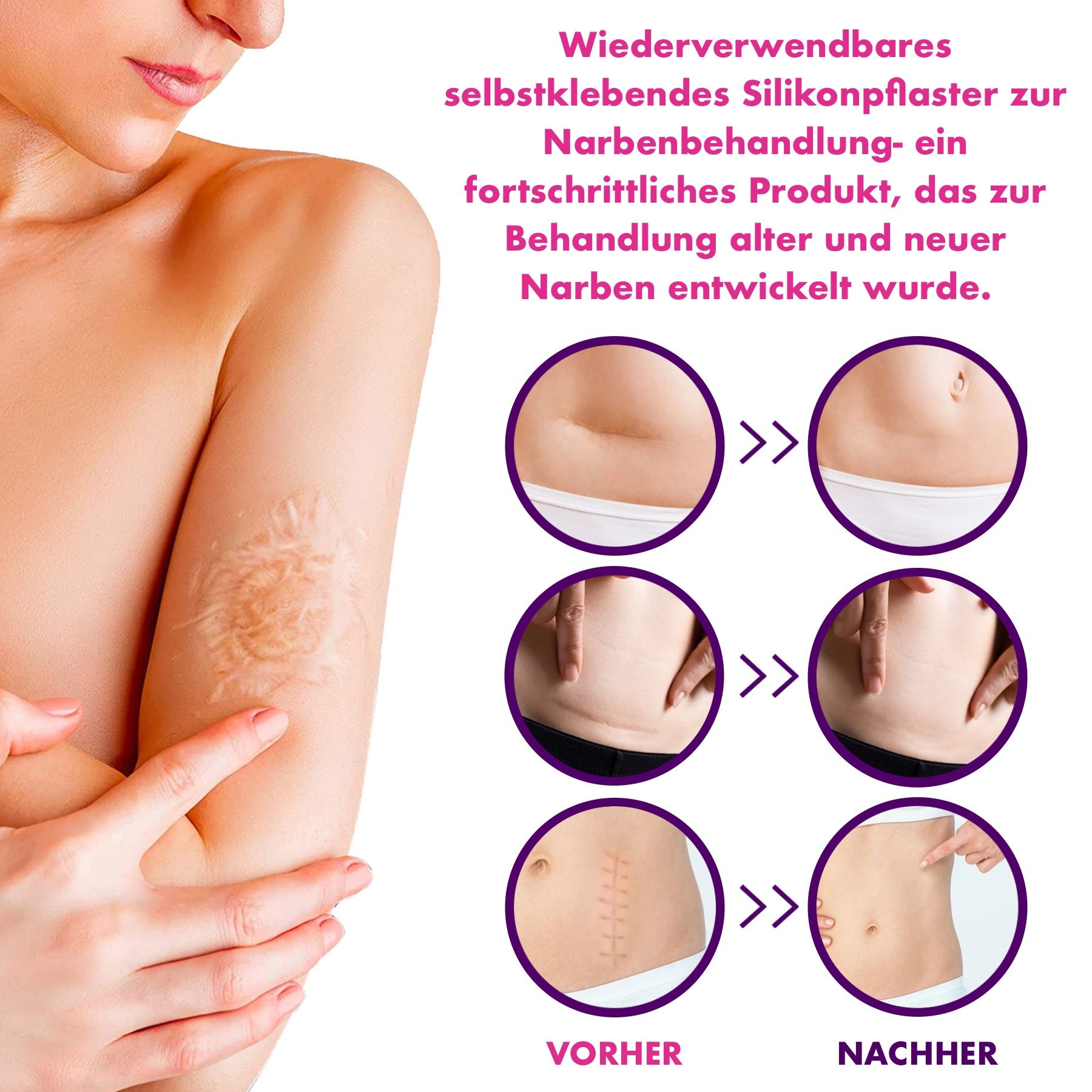 P-Beauty Wundpflaster für Narben