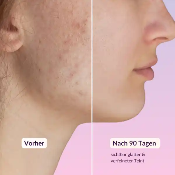 Retinol Facial Serum