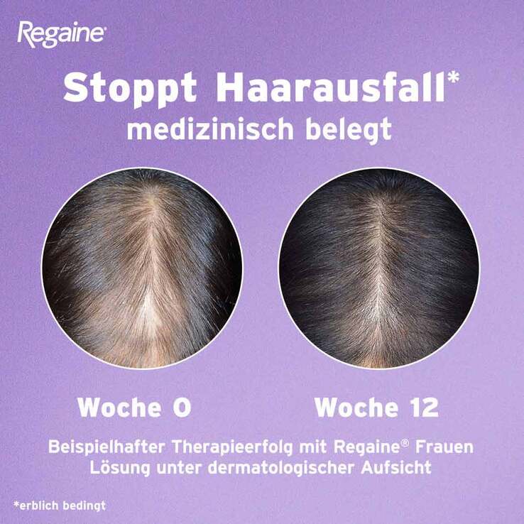 Regaine Frauen Schaum 50 mg/g , 2x2x60 g