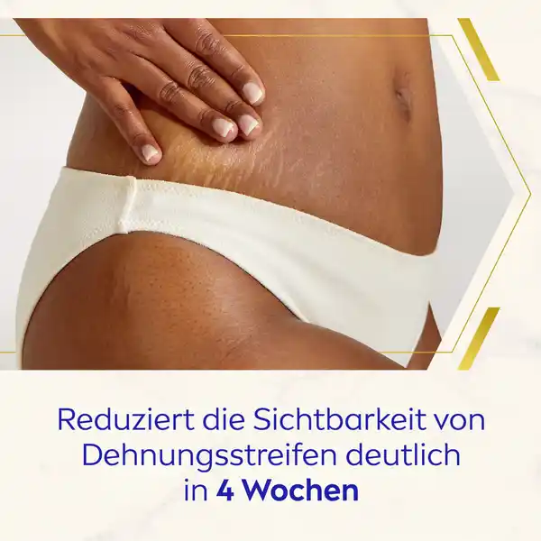 Body Creme Luminous630° Anti-Dehnungsstreifen
