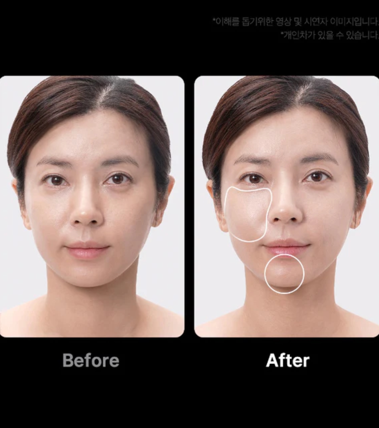 Medicube - *Age-R* - Dispositivo Avançado para Cuidados Faciais Booster Pro - Preto