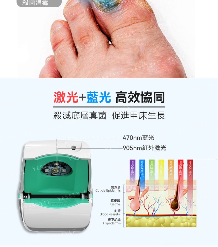 NEWEDO - Revolutionair laserapparaat voor de behandeling van nagelschimmel
