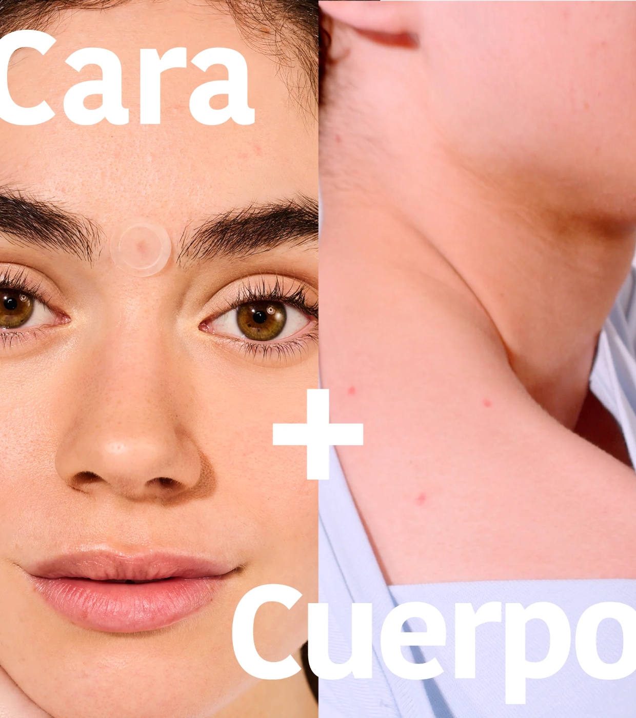 Iroha Nature - *Acne Prone Skin* - Adesivos de ácido salicílico para espinhas Microdarts