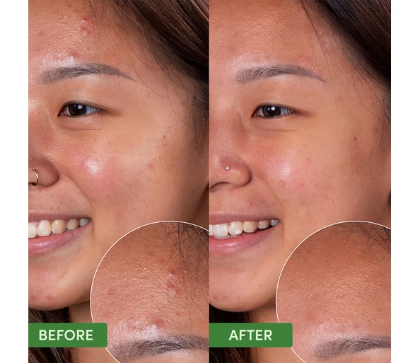 SAND & SKY Oil Control Clearing Face Mask