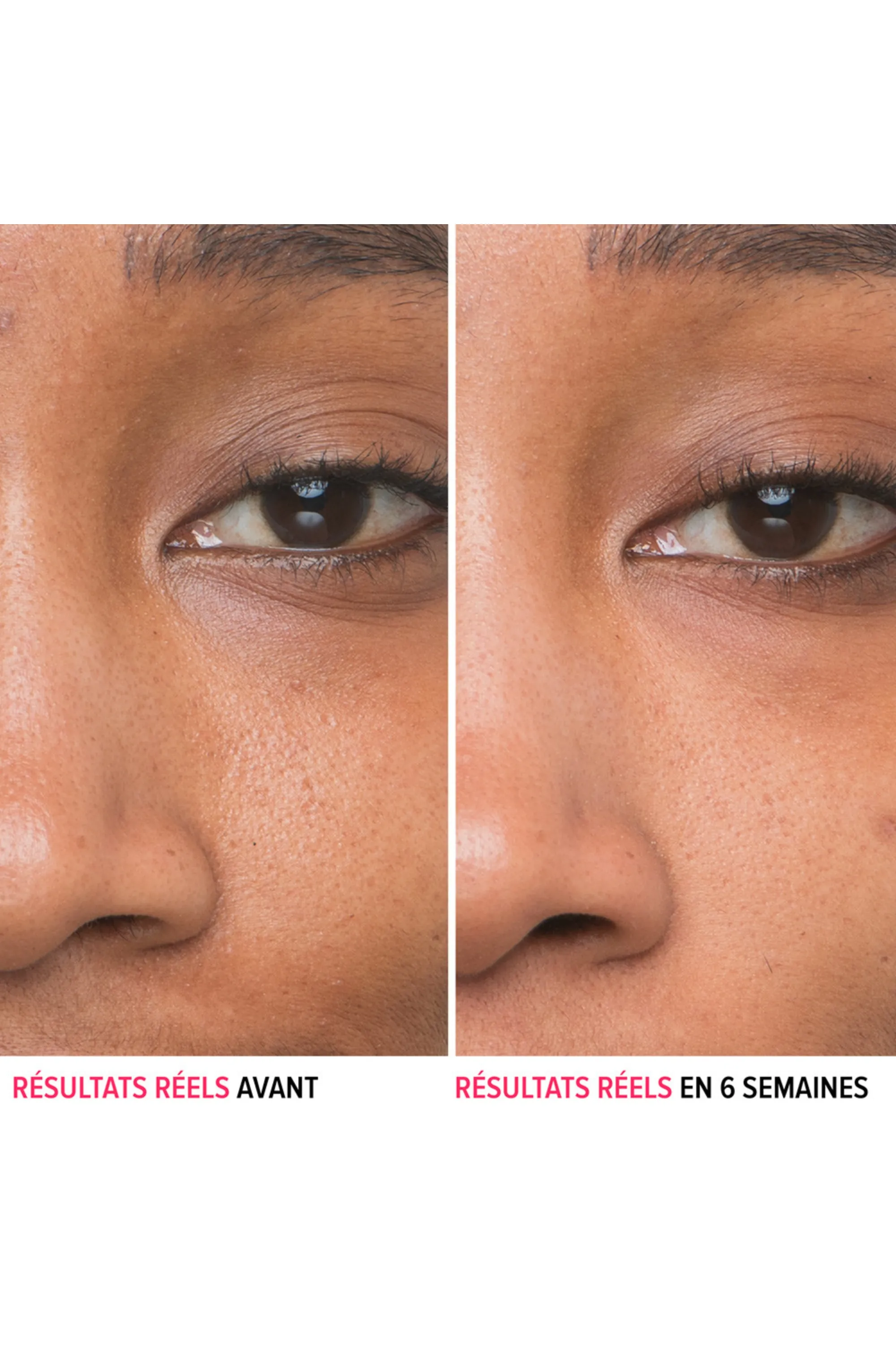 it Cosmetics Sérum anti-pores visibles à l’acide glycolique Bye Bye Serum-30 ml
