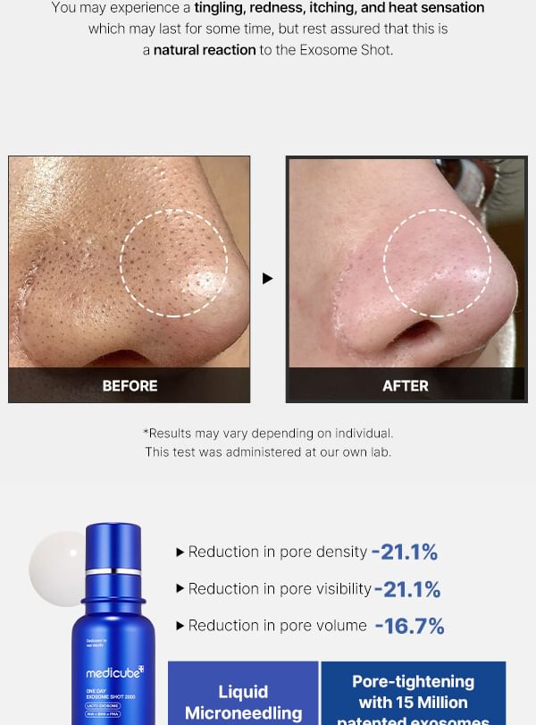 medicube - One Day Exosome Shot Pore Ampoule 7500
