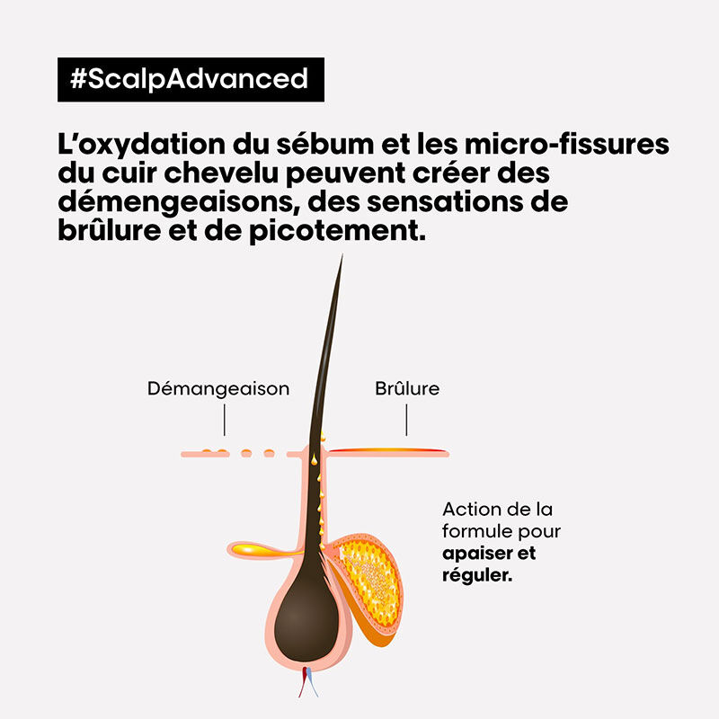Shampooing dermo-régulateur anti-inconfort Scalp Advanced 1500ml