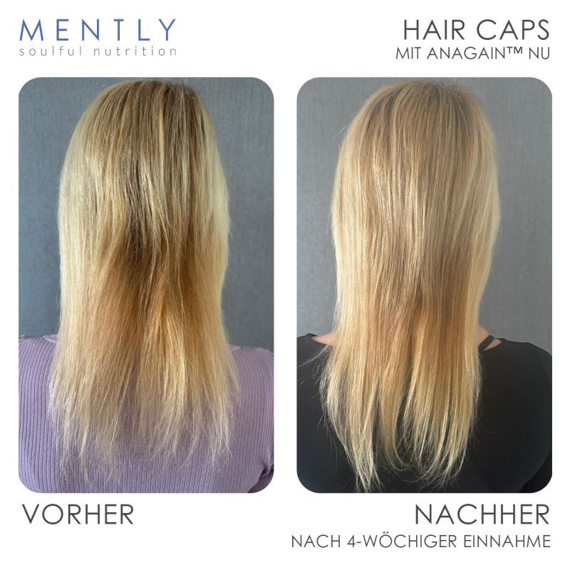 MENTLY Hair Caps