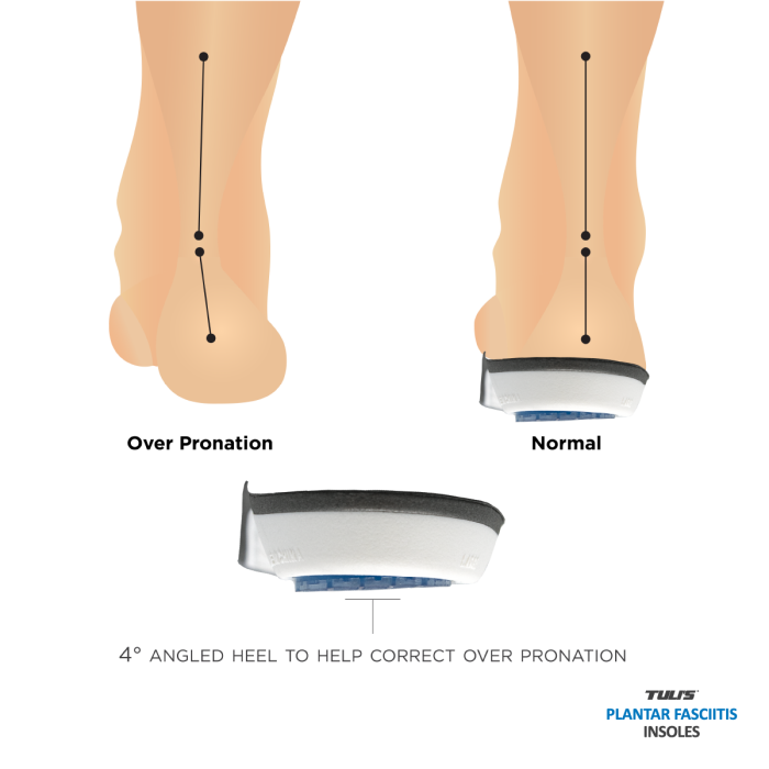 Sports Pharma Unisex Såler Tuli's Plantar Fasciitis Posts