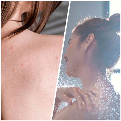 Biovène - Salicylic Blemish Scrub Detoxifying