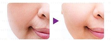 Zino - Anti-Age Elastine Lift Filler Essence