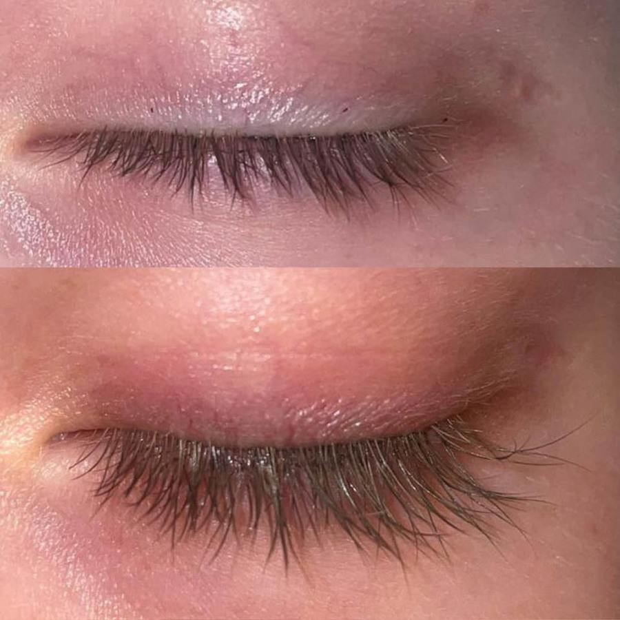 Lenoites ® Eyelash Activating Serum 5ml