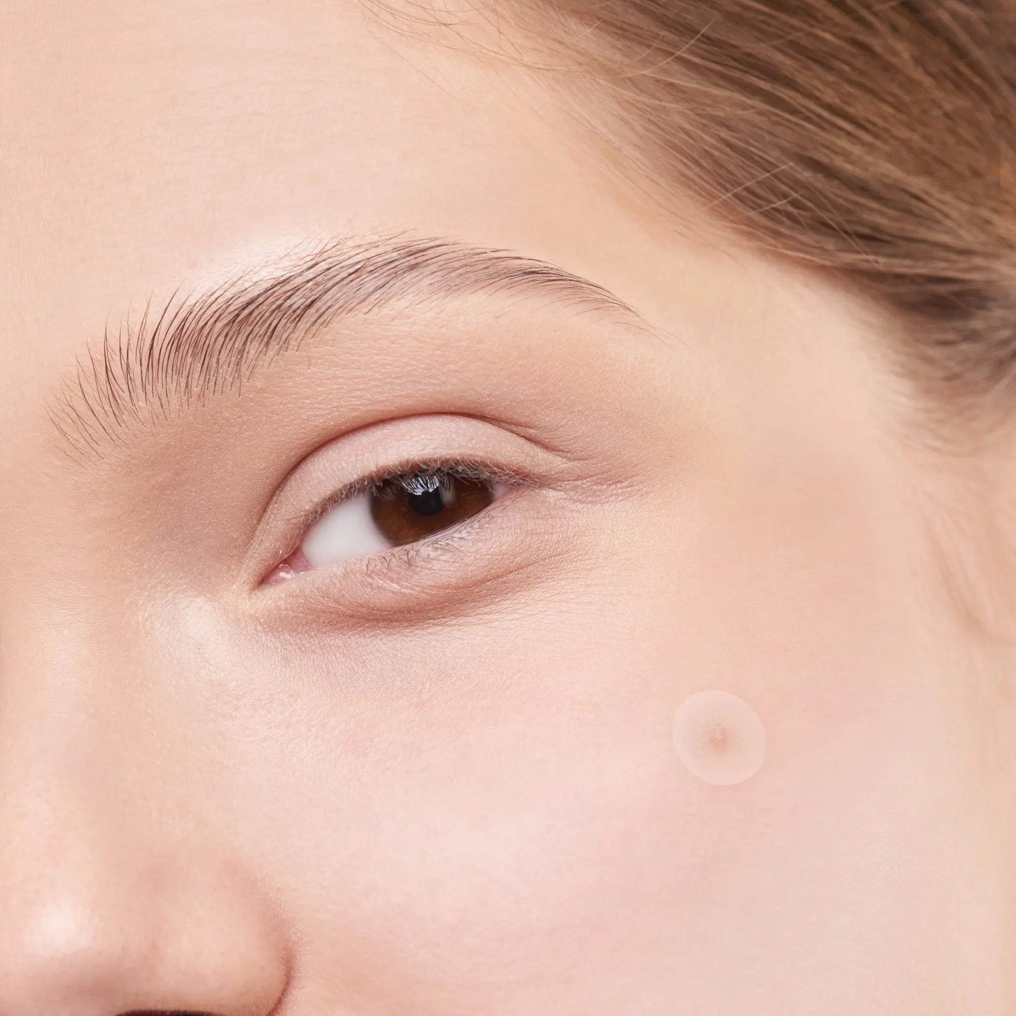 Pimple Patches