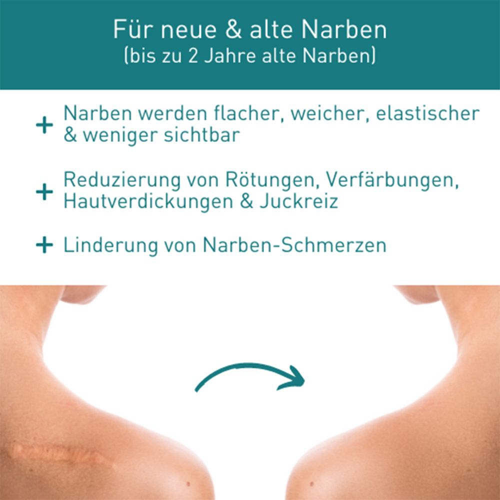 N1 Narbengel – reduziert Hautverdickungen, Rötungen, Verfärbungen & Schmerzen