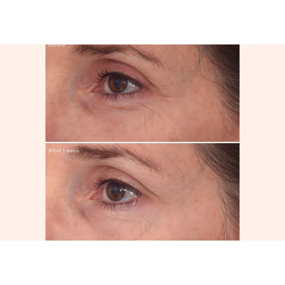 Murad Retinal Rescuplt Eye Treatment - 15 ml.