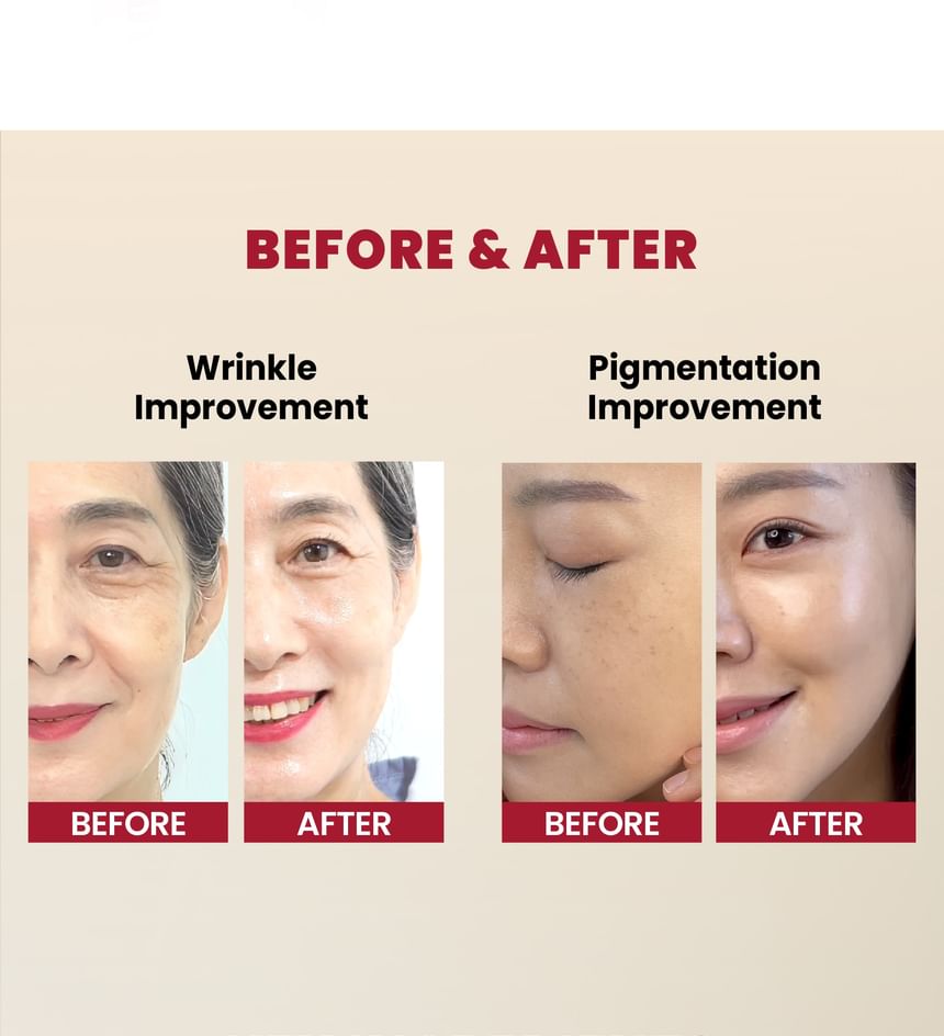 KSECRET - SEOUL 1988 Serum: Retinale Liposomen 2% + Zwarte Ginseng