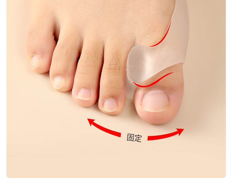 Caraboomie - Valgus Teen Correctie Brace (Diverse Ontwerpen)