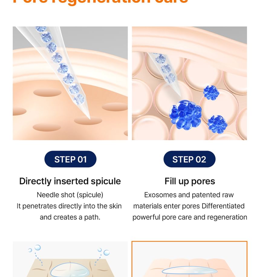 WellDerma - Facelifting Needle Shot Roller