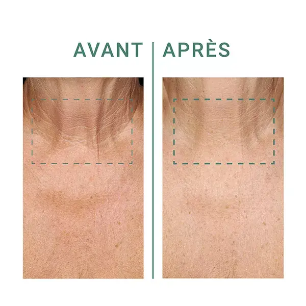 Creme Lifting Corporal Dr. Pierre Ricaud para Pescoço e Decote 50 mL