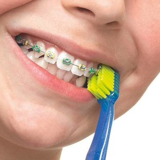Curaprox Tandenborstel Ultra Soft Ortho 1ST