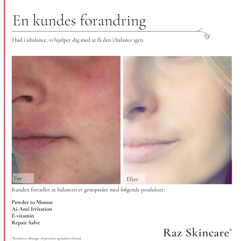 Raz Skincare Repair 15 ml