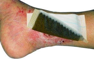 VLIWAKTIV Ag Aktivkohle Verband 10 x 20 cm steril, 10 Stück