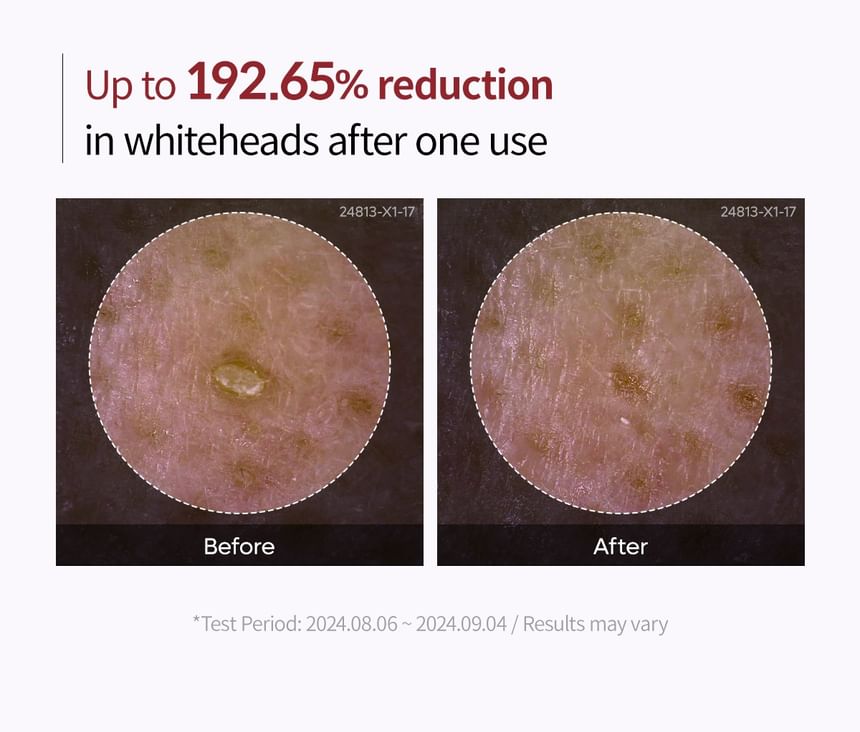 Dr.Melaxin - Peel Shot Exfoliant Zwarte Rijst Ampul