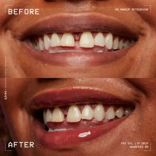 Fat Oil Lip Drip Newsfeed