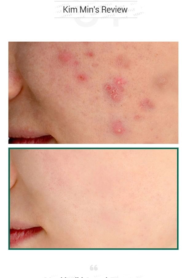 SOME BY MI - AHA, BHA, PHA 30 Dagen Wonder Serum 50ml
