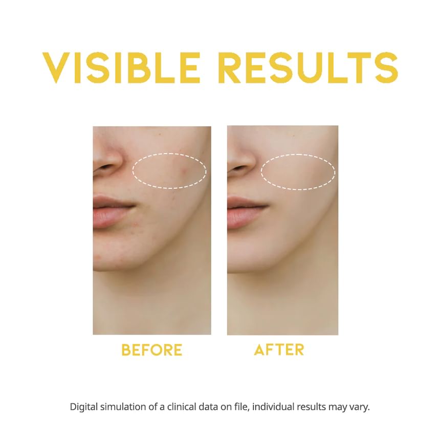 OOTD - Vitamine C Serum tegen Donkere Vlekken