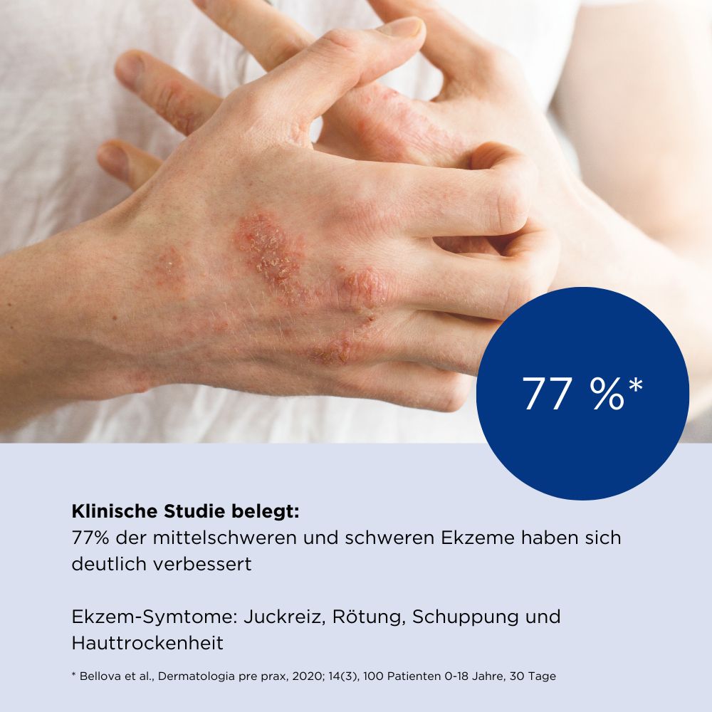ALLERGIKA® Nachtkerzenölcreme 20% MED - Jetzt 2 Euro sparen mit code ,,allergika2''
