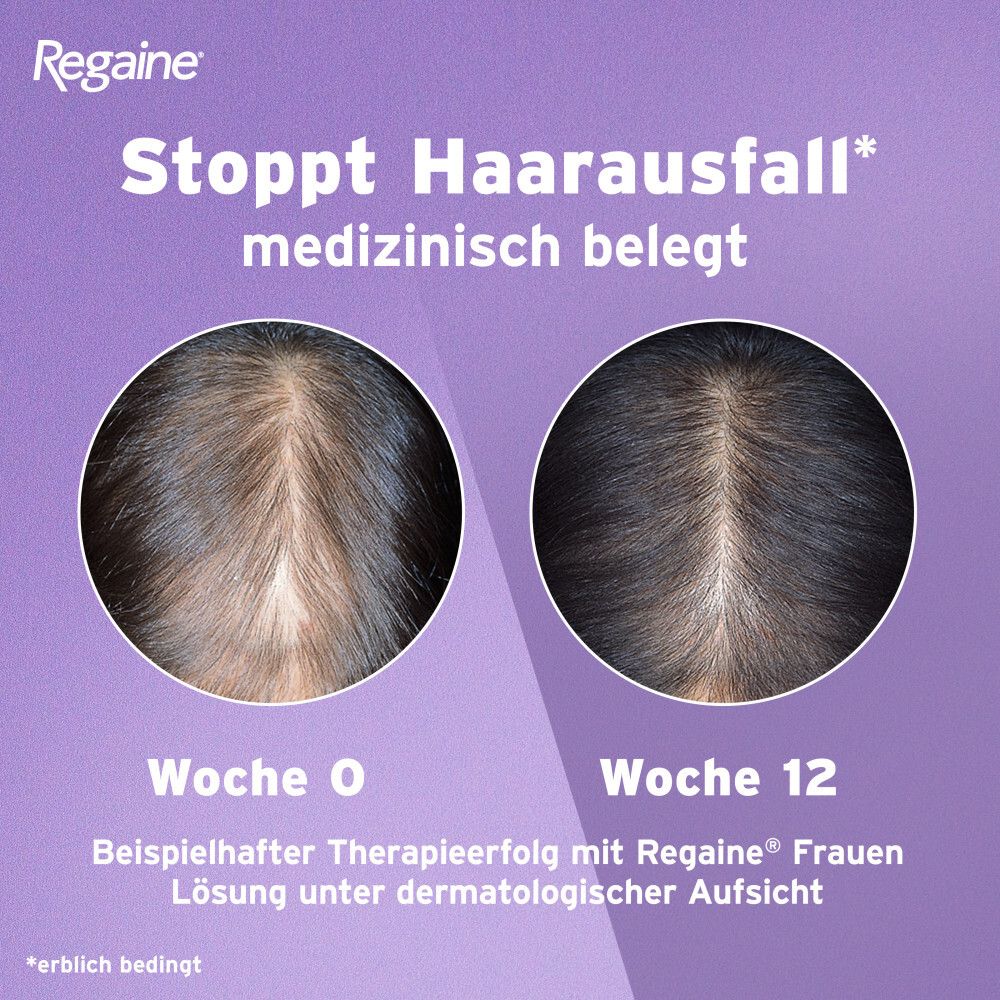 Regaine® Frauen Lösung mit 2% Minoxidil