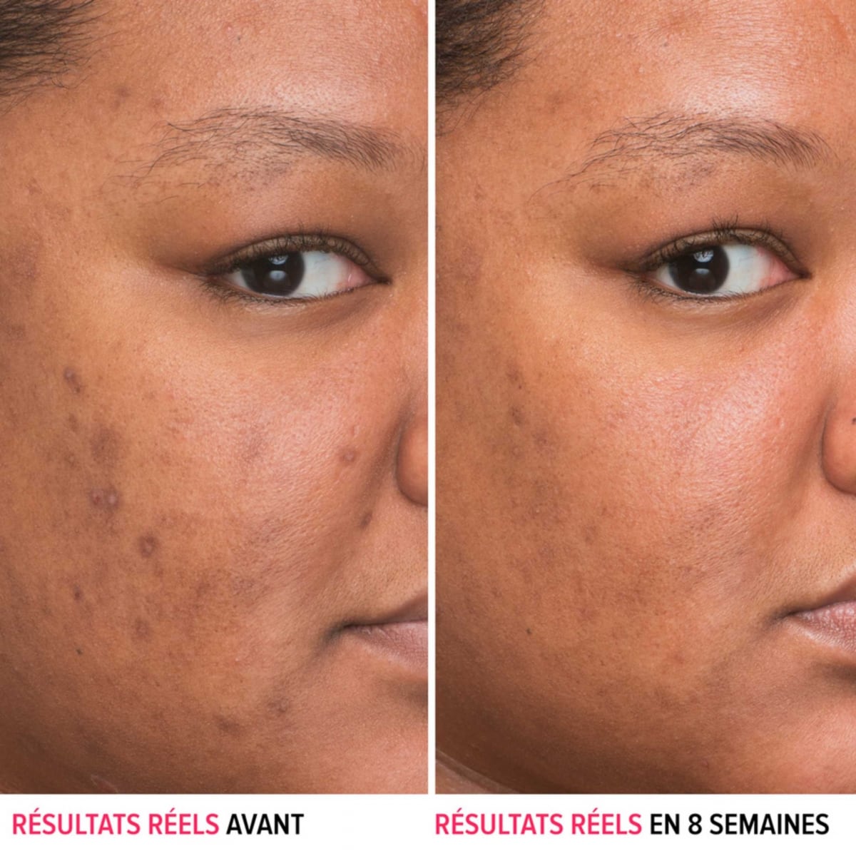 It Cosmetics Bye Bye Dark Spots Sérum Anti-taches à la Niacinamide