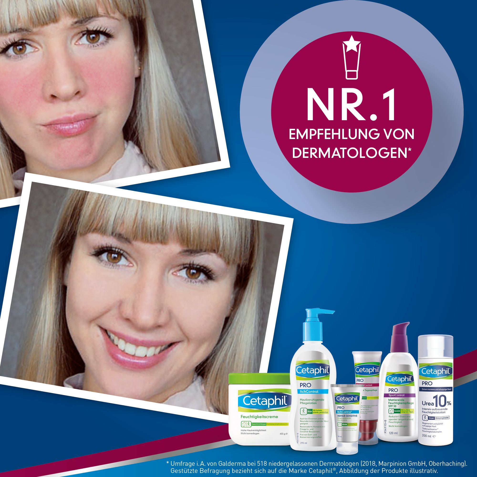 CETAPHIL PRO RednessControl Creme zur Symptombehandlung bei Gesichtsrötungen