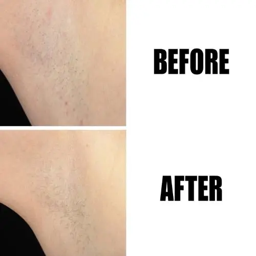 Glycolic Acid Exfoliating Body Stick