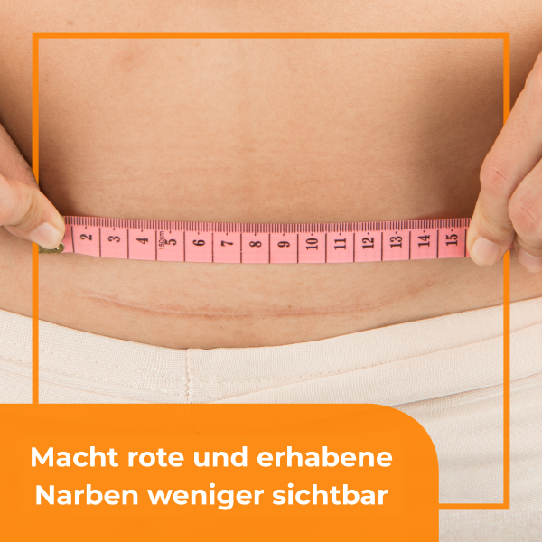 BEPANTHEN DERMA Narben-Gel<br>20 g, Tube, Gel