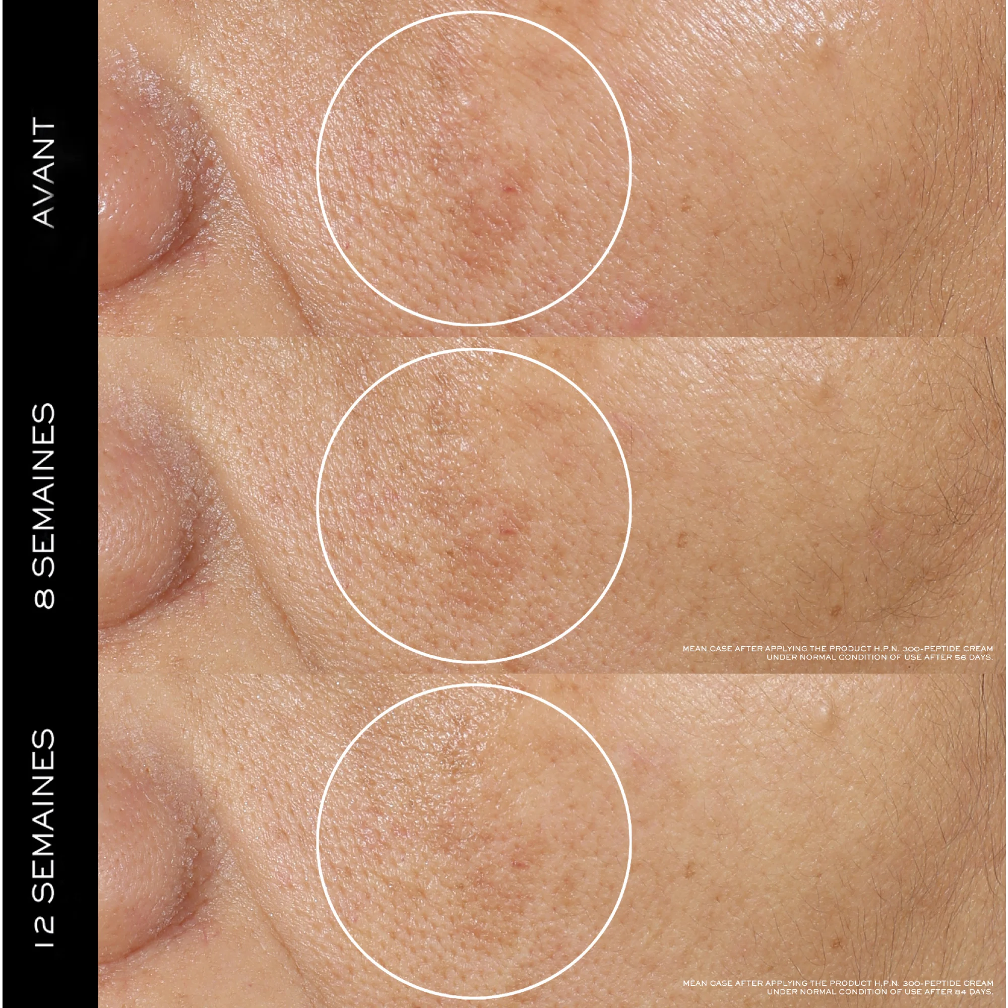 Crème Rénergie H.P.N. 300-Peptide |