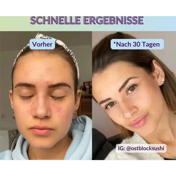 Hyaluronic Facial Gel
