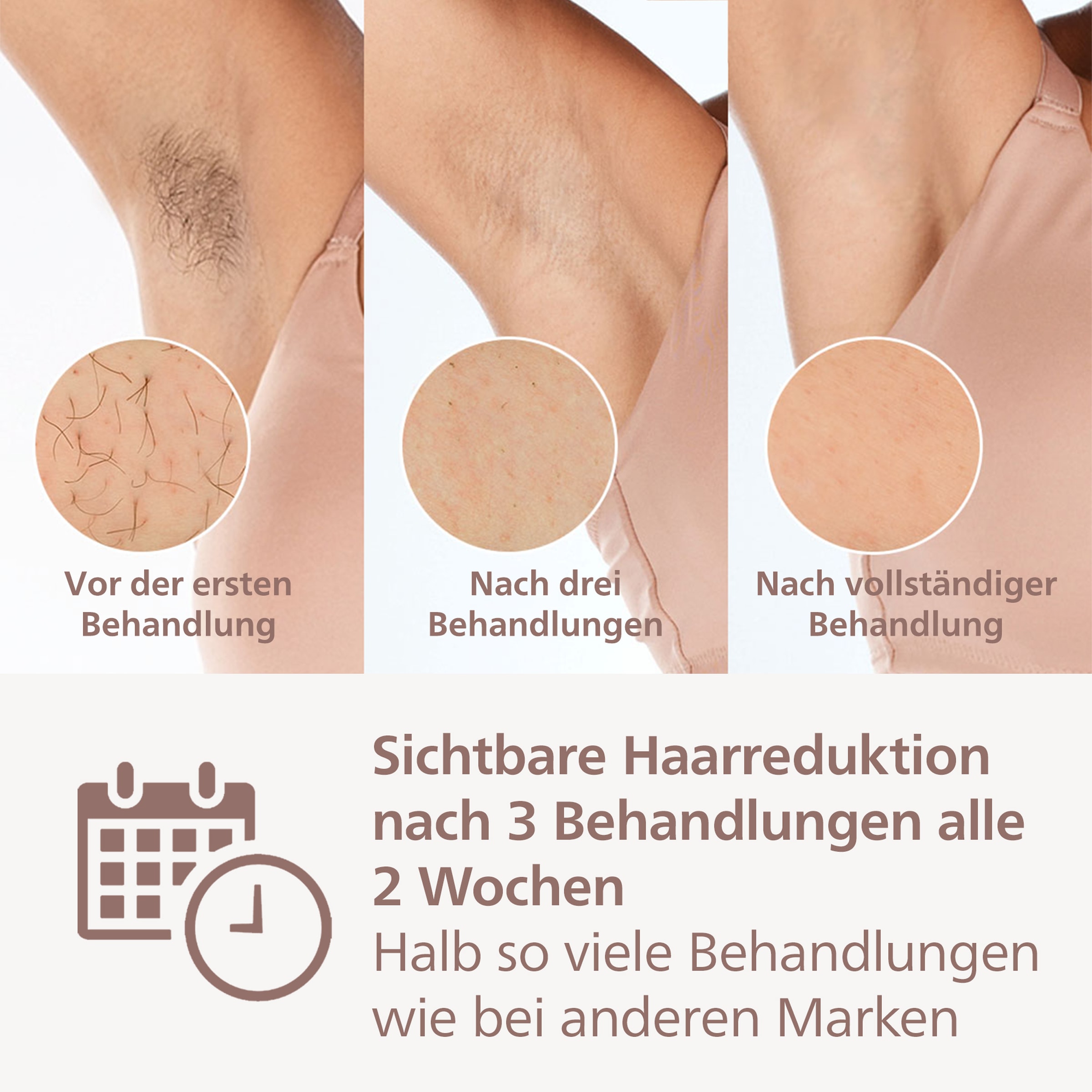 Philips IPL-Haarentferner »Lumea S9000 BRI958/00« 450.000 Lichtimpulse 4 Aufsätze (Achseln, Bikinizone, Körper und Gesicht), kabellos