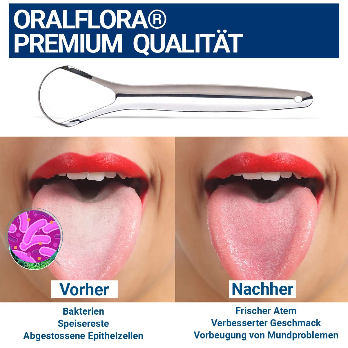 Oralflora  Zungenschaber aus Edelstahl  Zungenreiniger