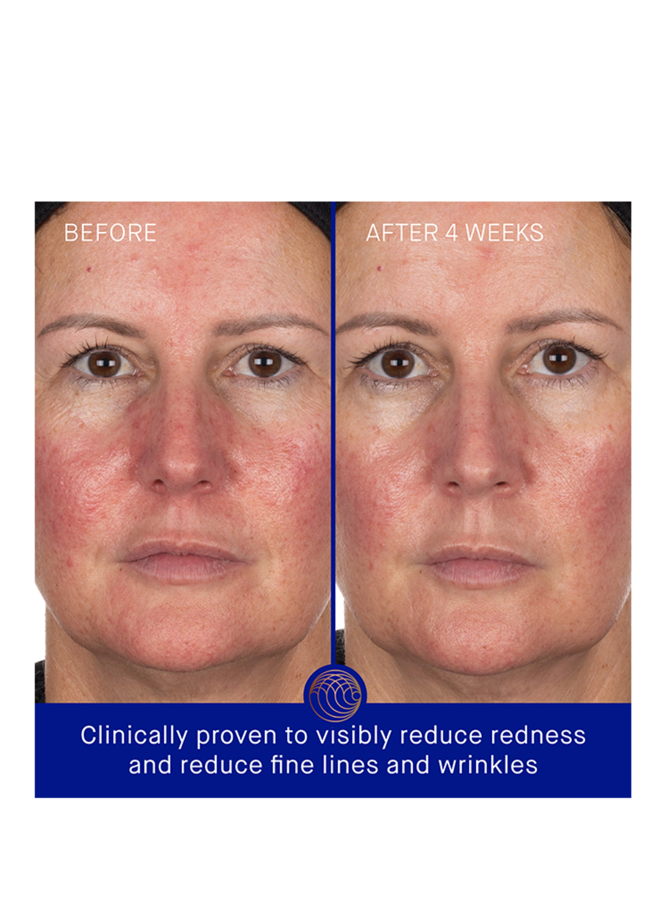 Augustinus Bader THE HYDROGEL FACE MASK SINGLE