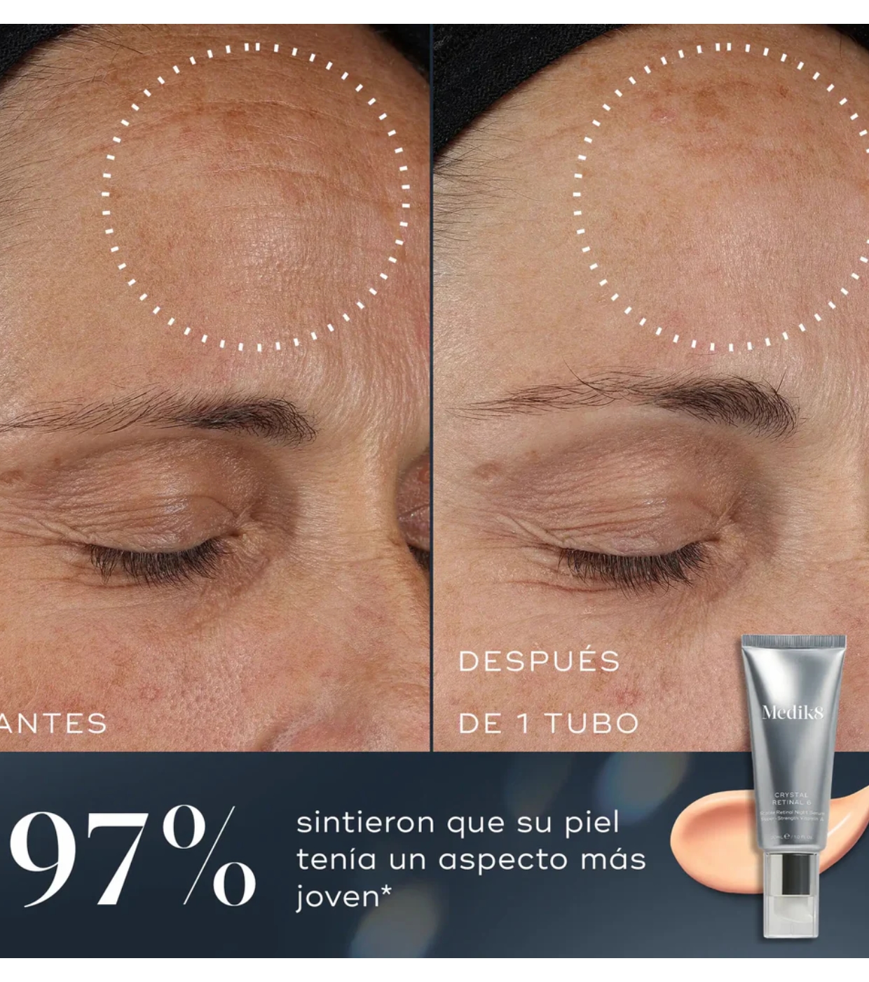 Medik8 - *Crystal Retinal* - Sérum noturno antienvelhecimento para rosto com Retinal e Vitamina A Crystal Retinal 1